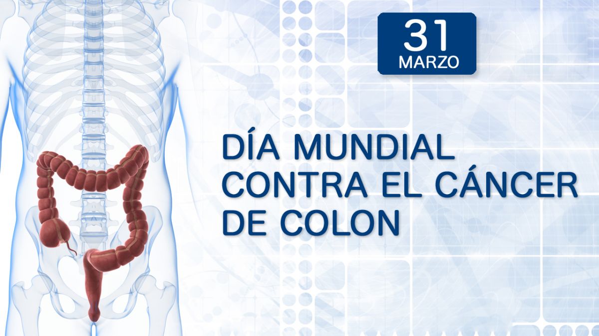 Foto noticia OSPeCon - Día Mundial contra el cáncer de colon y recto